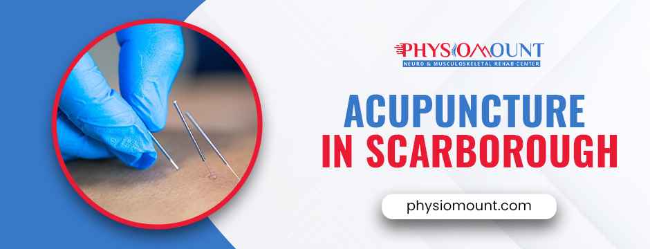 acupuncture in scarborough